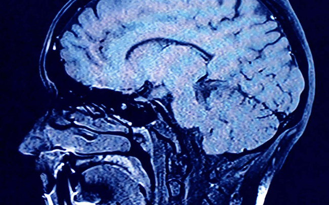 Neuropsihijatrija